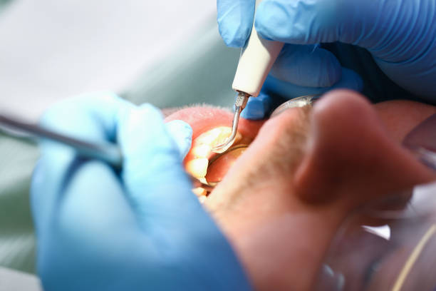 Best Emergency Treatment for Toothache in Coral Terrace, FL