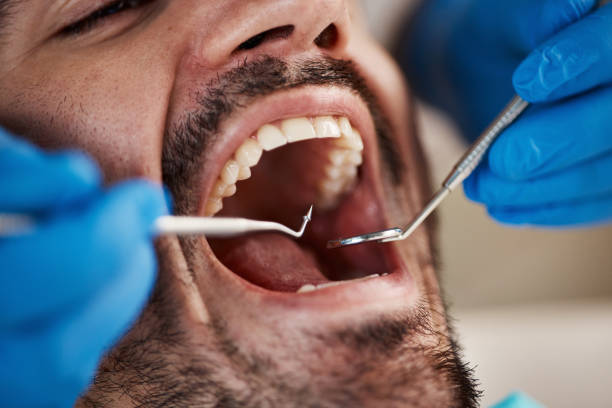 Best Walk-In Emergency Dentist in Coral Terrace, FL