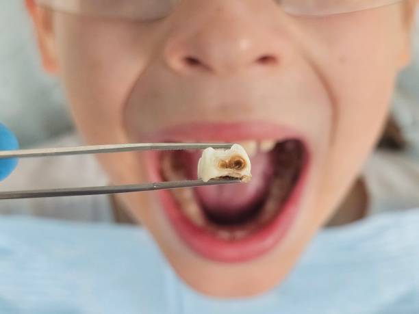 Best Weekend Emergency Dentist in Coral Terrace, FL